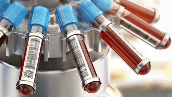 혈액검사 시스템